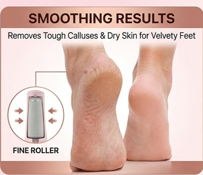 Rechargeable Foot Callus Remover with Extra Roller Head